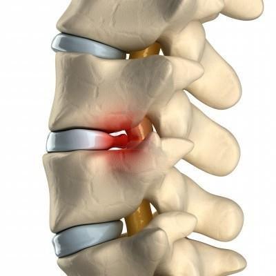 Болит бок со спины отдает в пах