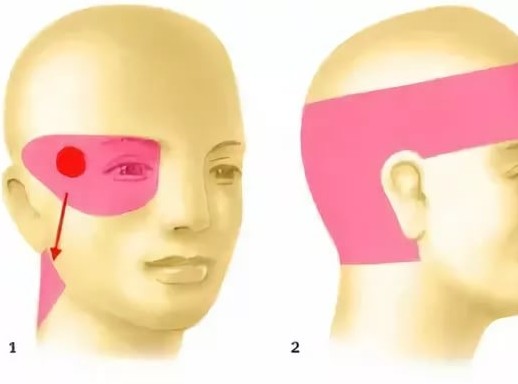 болит газ и голова