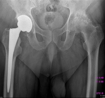 Болит бок со спины отдает в пах