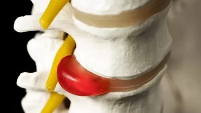 Можно ли делать массаж на спину если она болит