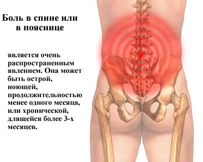 Отчего может очень болеть спина