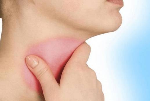 Болит горло болит голова температуры нету