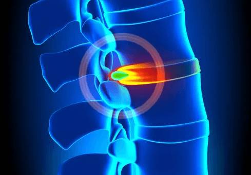 Болит в лопатке шее и голове