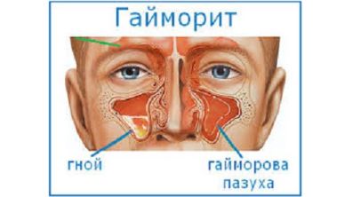 Почему каждый день болит голова и слабость