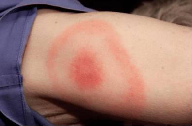 Почему каждый день болит голова и слабость