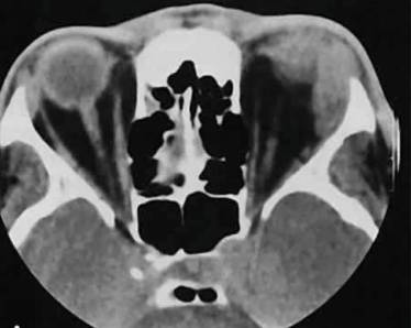 болит спина и бока температура