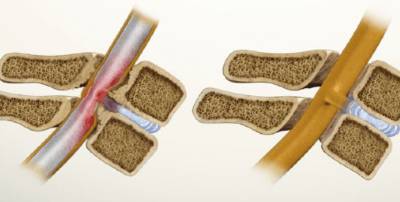 Болит бок со спины отдает в пах