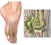 Кости болят с ног до головы