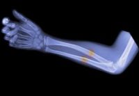 Кости болят с ног до головы