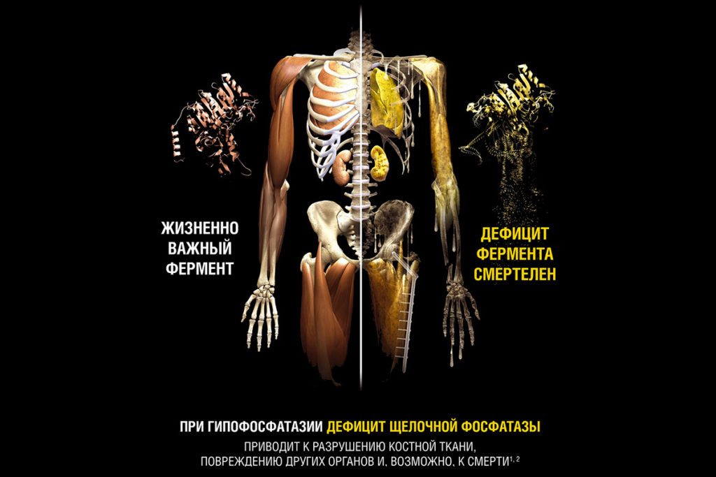 Чем лечить когда болят кости спины