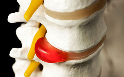 Болит бок со спины отдает в пах