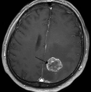 Почему каждый день болит голова и слабость