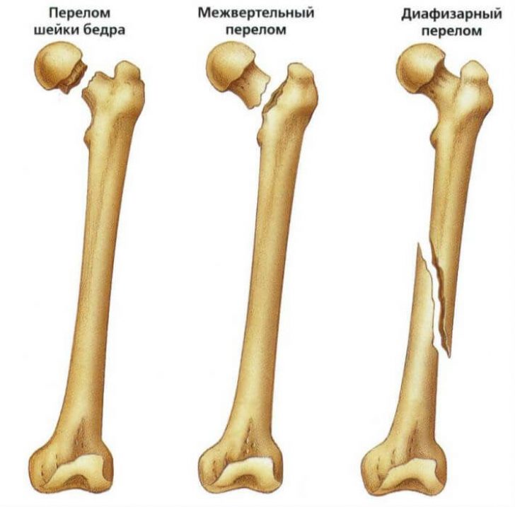 Чем лечить когда болят кости спины